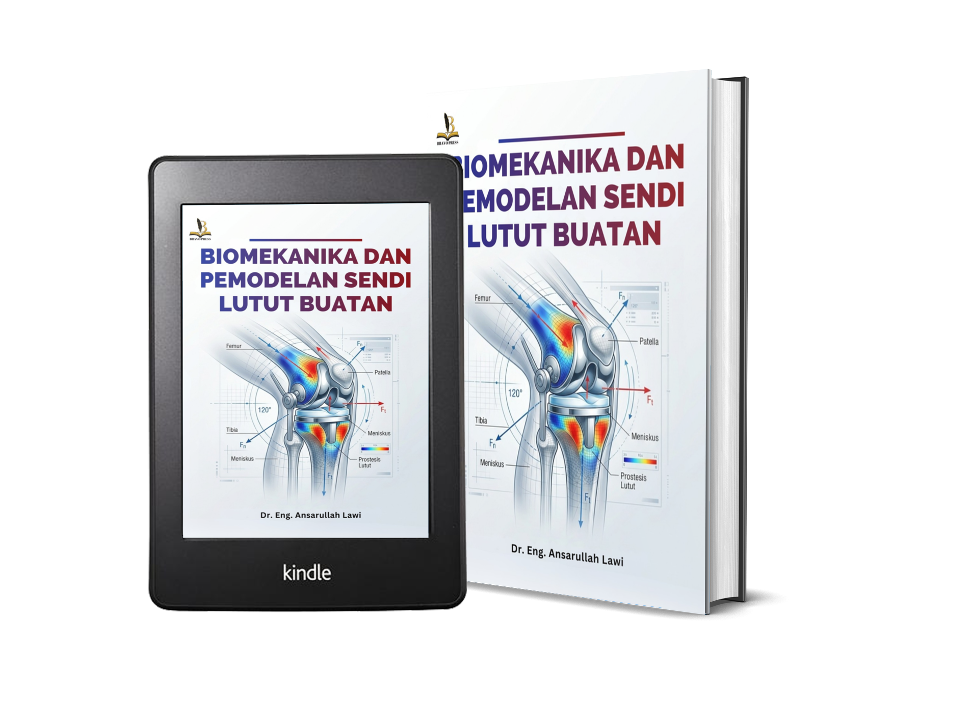 BIOMEKANIKA DAN PEMODELAN SENDI LUTUT BUATAN